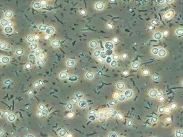 污水處理工藝選擇時要考慮的7個因素